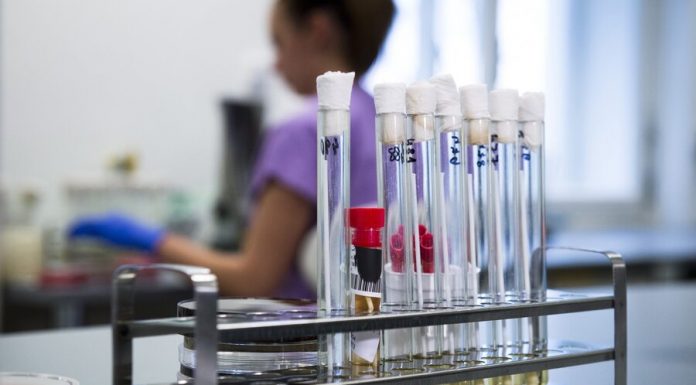 The CPS will assist the who in the diagnosis of coronavirus The CPS will assist the who in the diagnosis of coronavirus