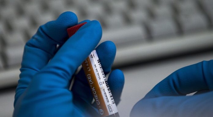 Russia responded to the request of WADA on public hearings on the dispute with RUSADA