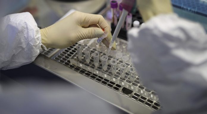 Test system for the detection of coronavirus recorded in Russia Test system for the detection of coronavirus recorded in Russia