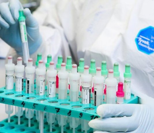 A day in Russia 601 confirmed a case of coronavirus infection