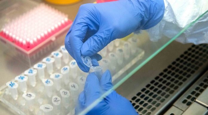 In Moscow for the day revealed 536 new cases COVID-19 In Moscow for the day revealed 536 new cases COVID-19