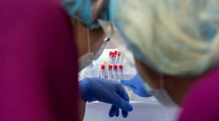 New test system for identifying COVID-19 registered in Russia