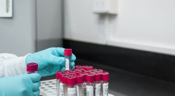 The Professor estimated the possibility of infection is more dangerous COVID-19