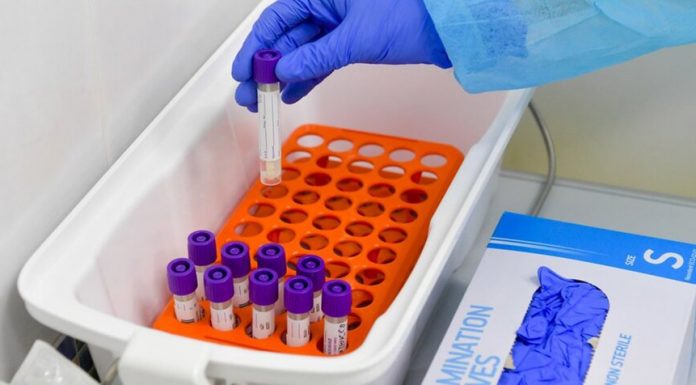 Was the first Russian test for coronavirus