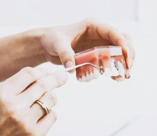 5 Things to Expect During Your Dental Implant Surgery